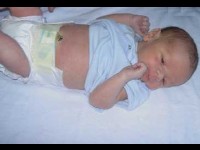 L'érythème fessier : symptômes et traitements