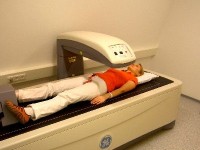 L'ostéoporose : traitements et moyens de prévention