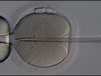 La fécondation in vitro : présentation et histoire