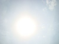 La migraine avec aura : symptômes et traitements