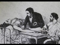 La transfusion sanguine : histoire d'une invention