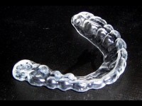 Le bruxisme ou grincement de dents : causes et traitement