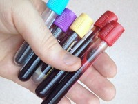 Le cancer du poumon : bientôt dépisté par une simple prise de sang ?