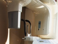 Le Cone Beam : principe et déroulement de l'examen