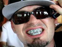 Le grillz : un accessoire dentaire bling-bling