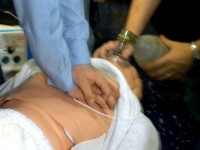 Le massage cardiaque : guide pratique