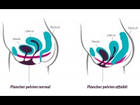 Le Périnée : STOP aux tabous de ce muscle essentiel