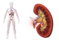Le rein : un organe vital