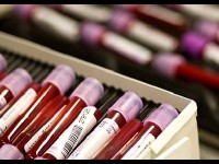 Les groupes sanguins : présentation et caractéristiques