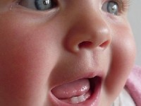 Les poussées dentaires : quelles solutions ?