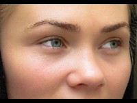 Les premières rides : quelles solutions ?