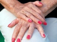 Les taches brunes sur la peau : causes et solutions