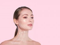Lifting du visage : tout comprendre en 5 questions