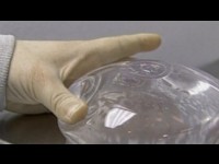 PROTHESES MAMMAIRES :  Comment choisir ses implants ?