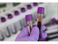 Santé : c'est quoi, une maladie auto-immune ?