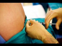 Tout savoir sur la péridurale