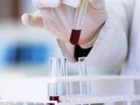 Un traitement contre Ebola étudié pour le Coronavirus